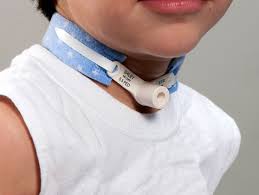PEDIPRINTS 3/4"" W TRACH COLLAR, FITS UP TO 9"" NECK